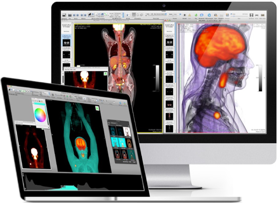 Dicom viewer for mac free download